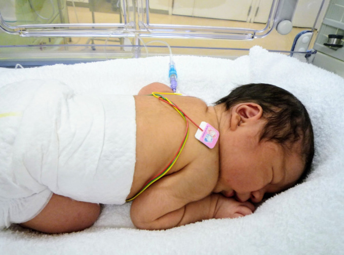 新生児集中治療室の看護師給料